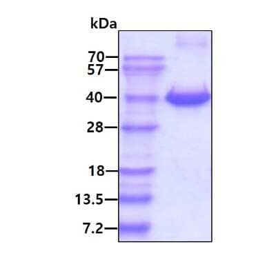 SDS-PAGE Recombinant Human FKBP6 His Protein